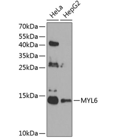 MYL6 Rabbit Polyclonal Antibody