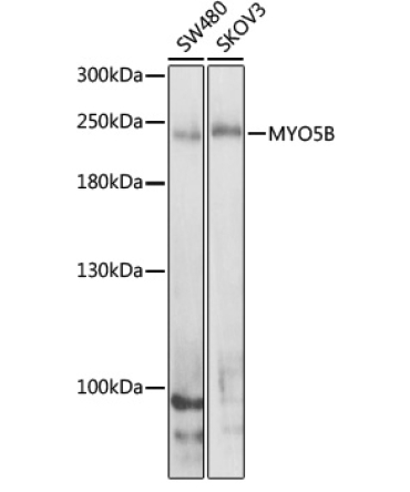 MYO5B Rabbit Polyclonal Antibody