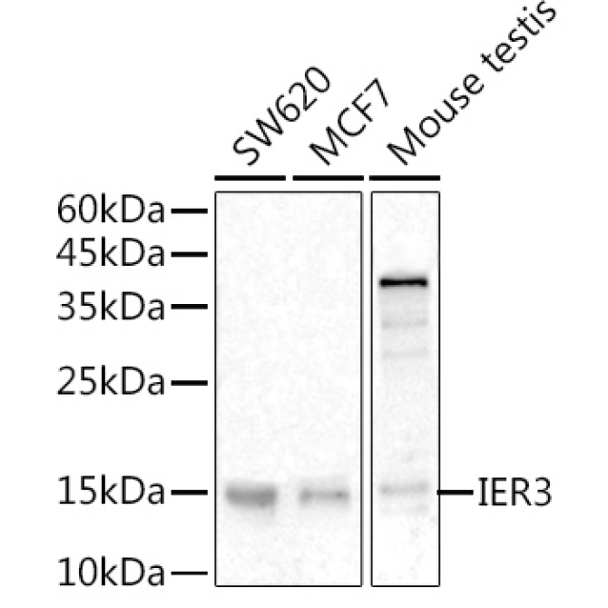 IER3 Rabbit Polyclonal Antibody