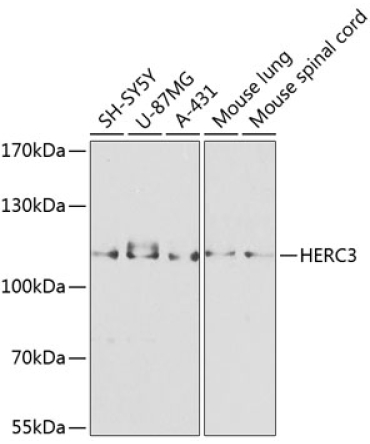 HERC3 Rabbit Polyclonal Antibody