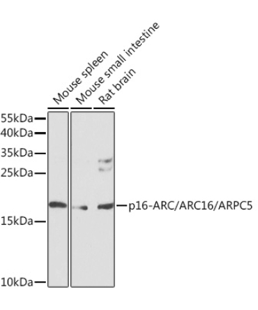 p16-ARC/ARC16/ARPC5 Rabbit Polyclonal Antibody