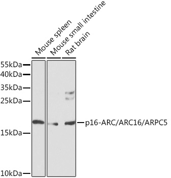 p16-ARC/ARC16/ARPC5 Rabbit Polyclonal Antibody