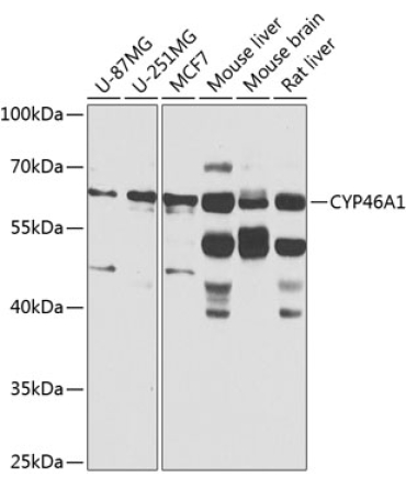 CYP46A1 Rabbit Polyclonal Antibody