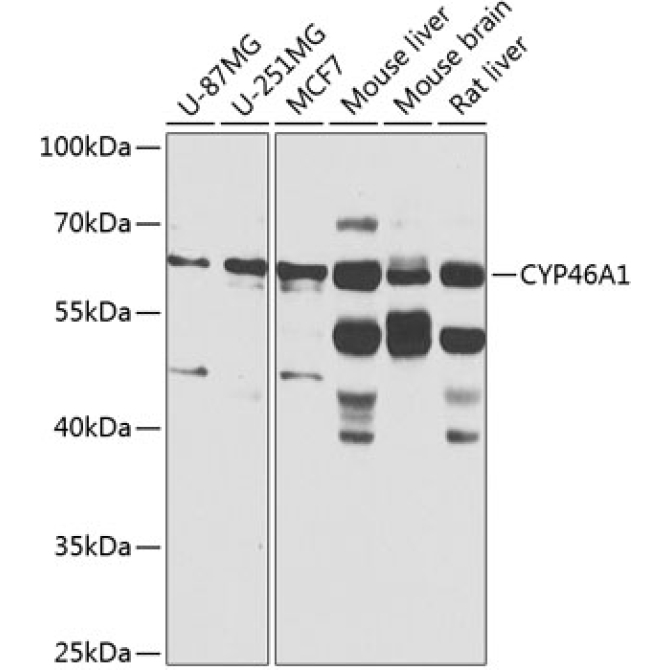 CYP46A1 Rabbit Polyclonal Antibody