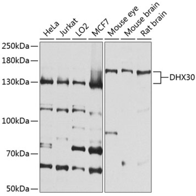 DHX30 Rabbit Polyclonal Antibody