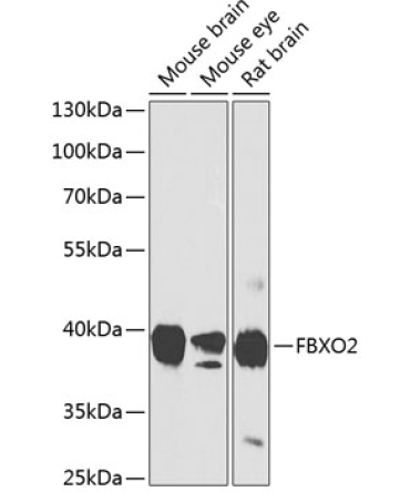 FBXO2 Rabbit Polyclonal Antibody