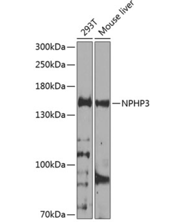 NPHP3 Rabbit Polyclonal Antibody