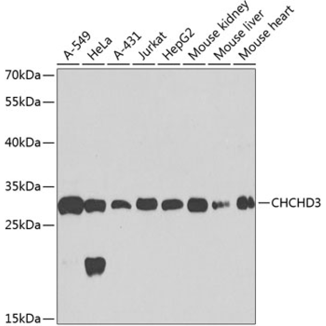 CHCHD3 Rabbit Polyclonal Antibody