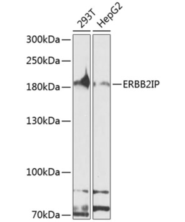 ERBB2IP Rabbit Polyclonal Antibody