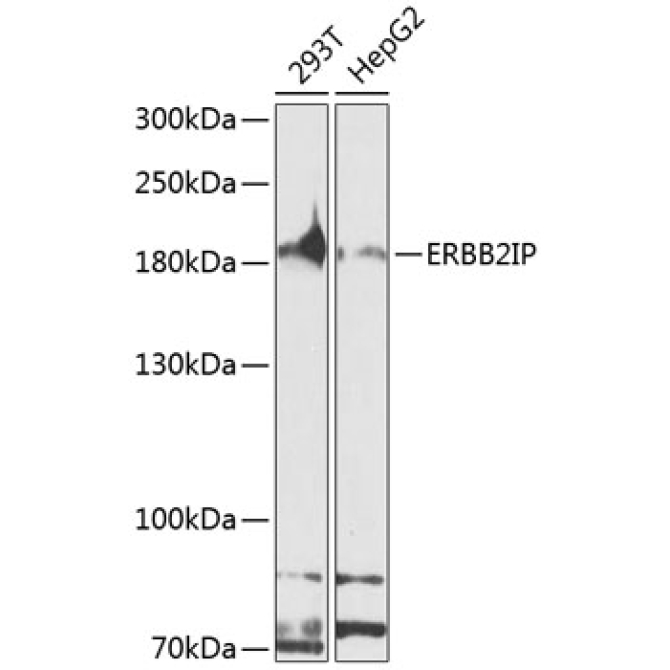 ERBB2IP Rabbit Polyclonal Antibody