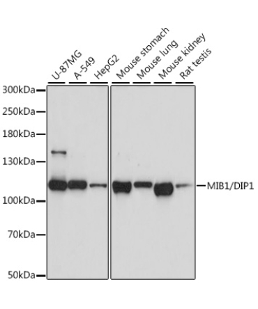 MIB1/DIP1 Rabbit Polyclonal Antibody