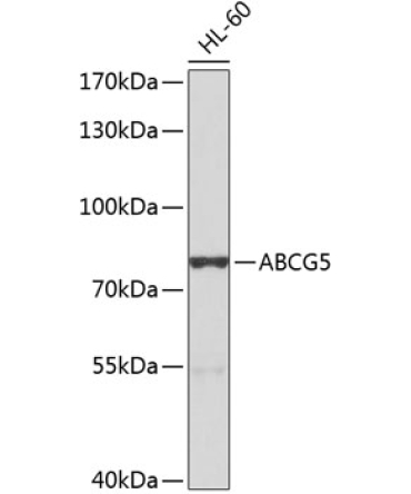 ABCG5 Rabbit Polyclonal Antibody