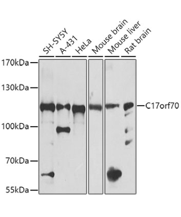 C17orf70 Rabbit Polyclonal Antibody