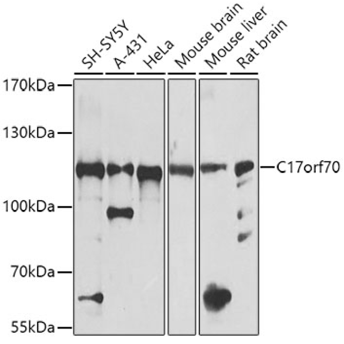 C17orf70 Rabbit Polyclonal Antibody