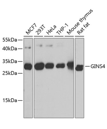 GINS4 Rabbit Polyclonal Antibody