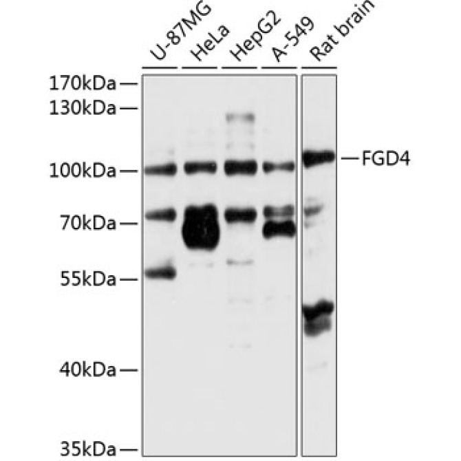 FGD4 Rabbit Polyclonal Antibody