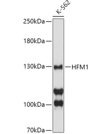 HFM1 Rabbit Polyclonal Antibody