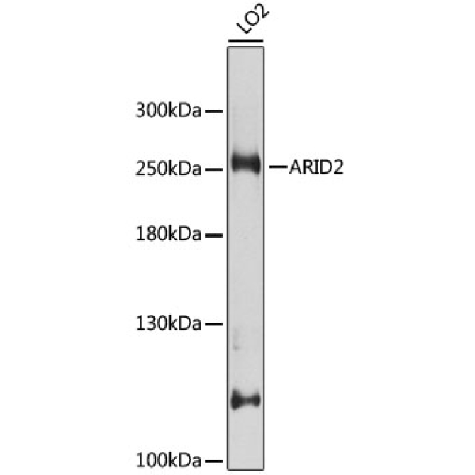 ARID2 Rabbit Polyclonal Antibody