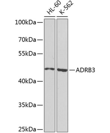 ADRB3 Rabbit Polyclonal Antibody