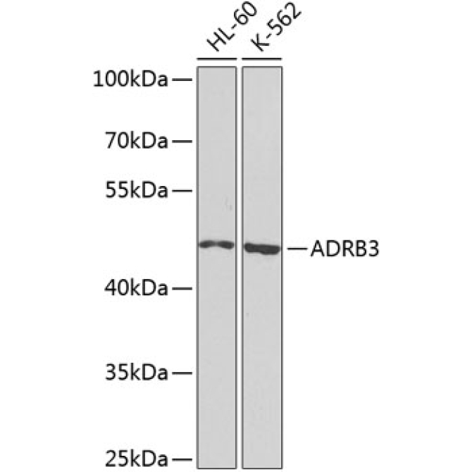 ADRB3 Rabbit Polyclonal Antibody