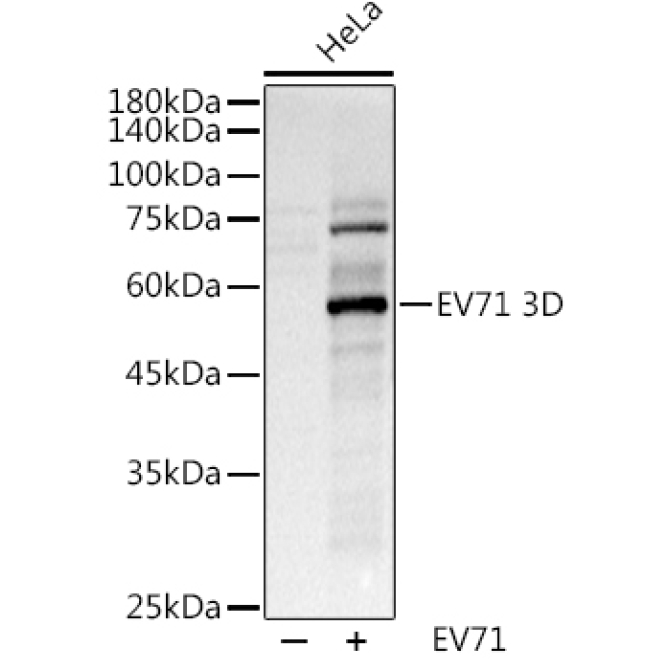 EV71 3D Rabbit Polyclonal Antibody