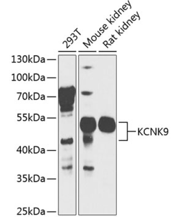 KCNK9 Rabbit Polyclonal Antibody