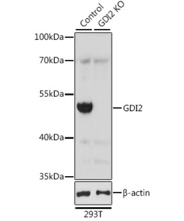 GDI2 Rabbit Polyclonal Antibody [KO Validated]