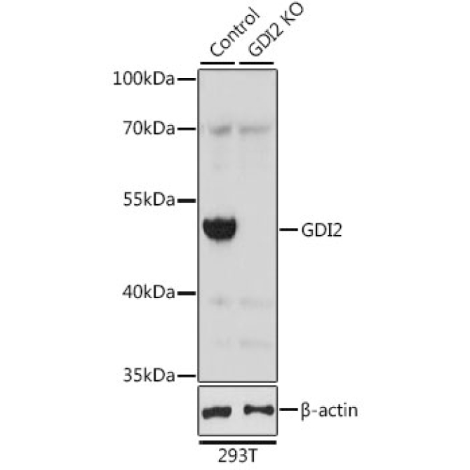 GDI2 Rabbit Polyclonal Antibody [KO Validated]