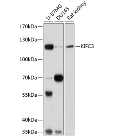 KIFC3 Rabbit Polyclonal Antibody