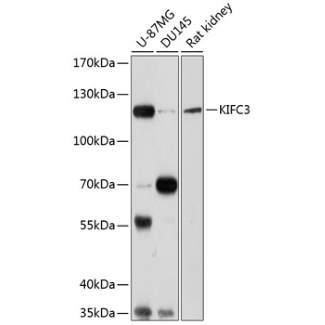 KIFC3 Rabbit Polyclonal Antibody