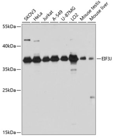 EIF3J Rabbit Polyclonal Antibody