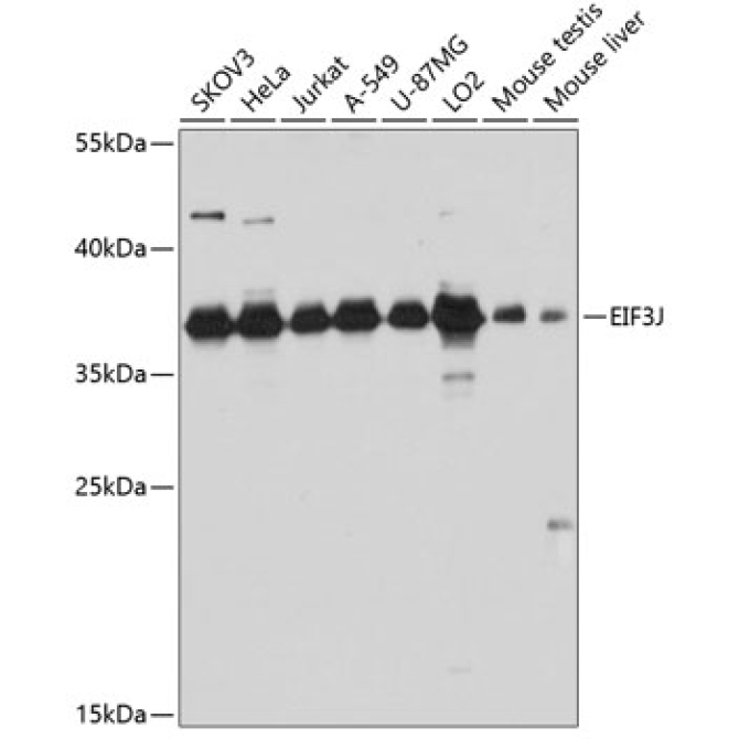 EIF3J Rabbit Polyclonal Antibody
