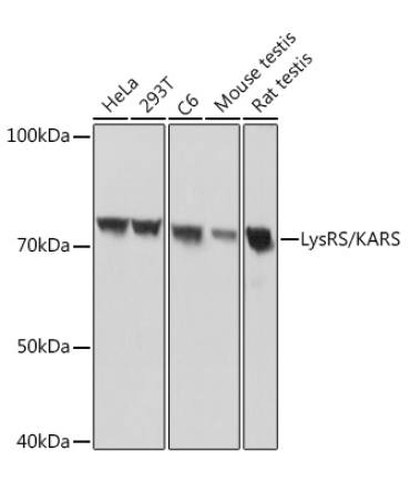 LysRS/KARS Rabbit Monoclonal Antibody