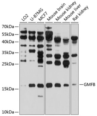 GMFB Rabbit Polyclonal Antibody