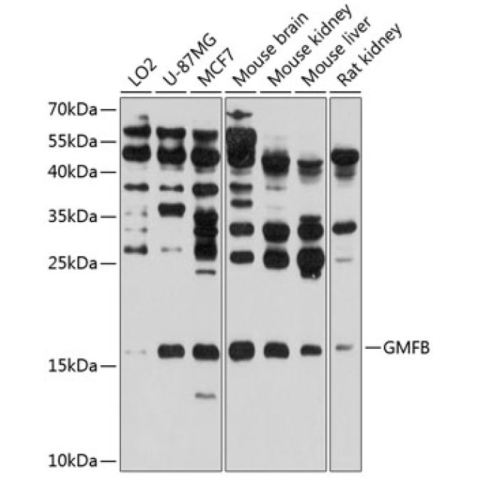 GMFB Rabbit Polyclonal Antibody