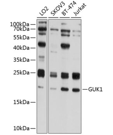 GUK1 Rabbit Polyclonal Antibody