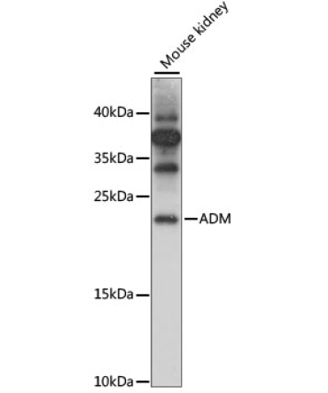 ADM Rabbit Polyclonal Antibody
