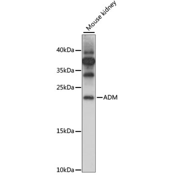 ADM Rabbit Polyclonal Antibody