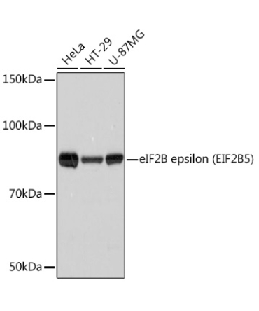 eIF2B epsilon (EIF2B5) Rabbit Monoclonal Antibody