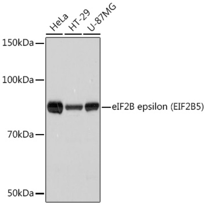 eIF2B epsilon (EIF2B5) Rabbit Monoclonal Antibody