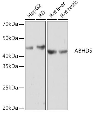 ABHD5 Rabbit Monoclonal Antibody