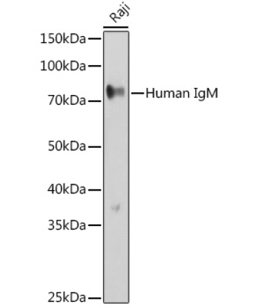 Human IgM Rabbit Polyclonal Antibody