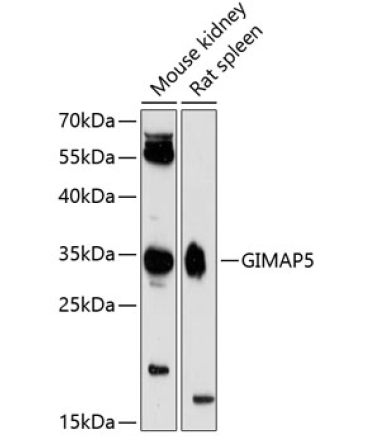 GIMAP5 Rabbit Polyclonal Antibody