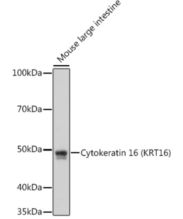 Cytokeratin 16 (KRT16) Rabbit Monoclonal Antibody