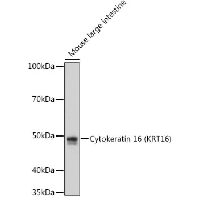 Cytokeratin 16 (KRT16) Rabbit Monoclonal Antibody