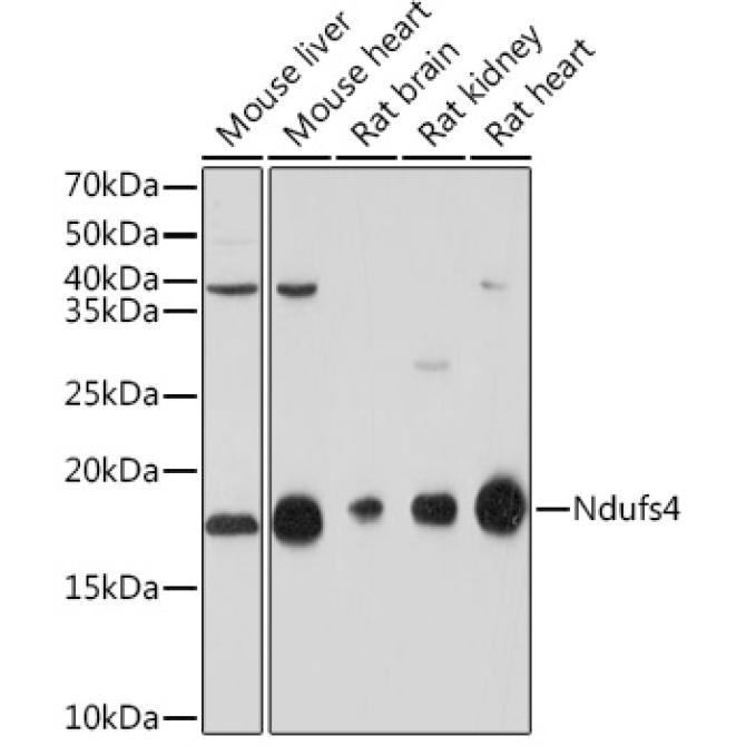 NDUFS4 Rabbit Monoclonal Antibody