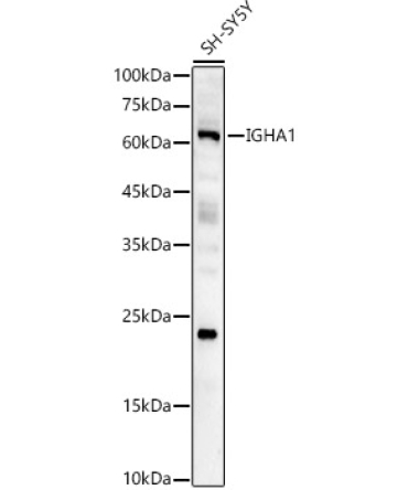 IGHA1 Rabbit Polyclonal Antibody