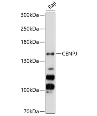 CENPJ Rabbit Polyclonal Antibody