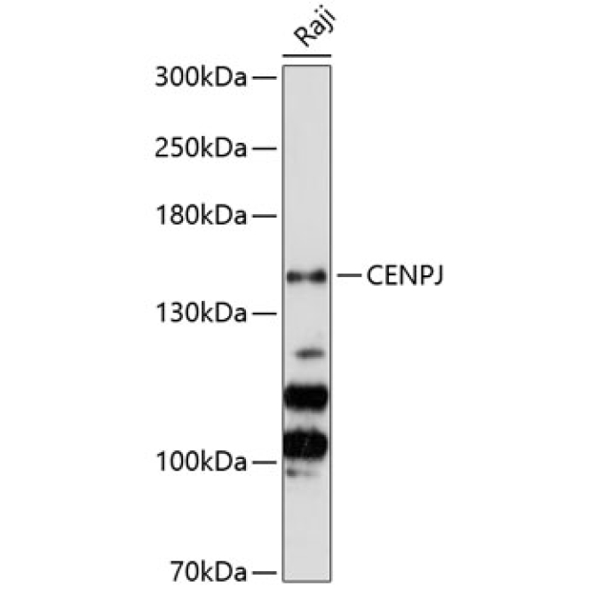 CENPJ Rabbit Polyclonal Antibody