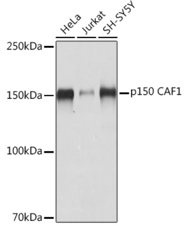p150 CAF1 Rabbit Monoclonal Antibody